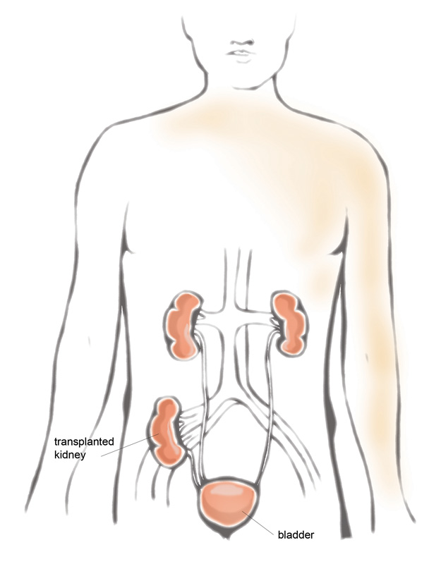 Kidney transplant principles