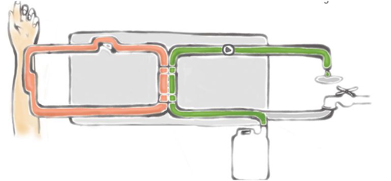 How does dialysis work